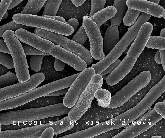 E. Coli under a microscope